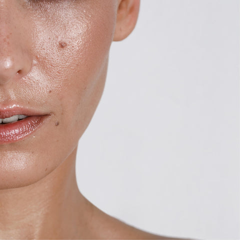 Sebum control