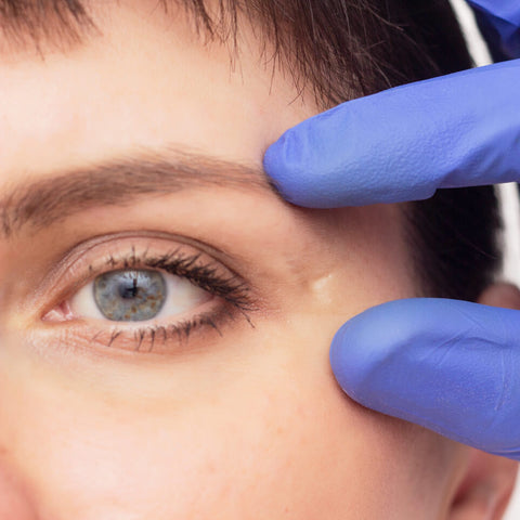 Skin repair